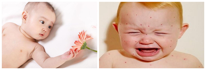 儿童湿疹反反复复，您有在家安装家用除湿产品吗？